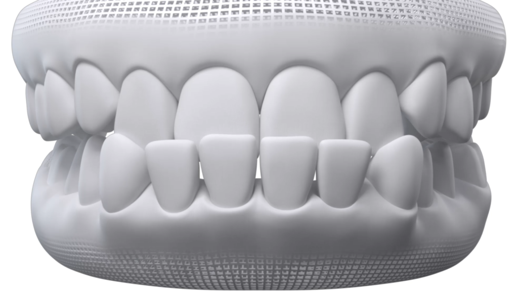qual a opção que descreve melhor o seu sorriso.