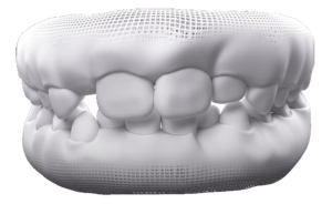 Dentes de Leite