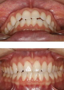 Qual opção melhor descreve o meu sorriso?