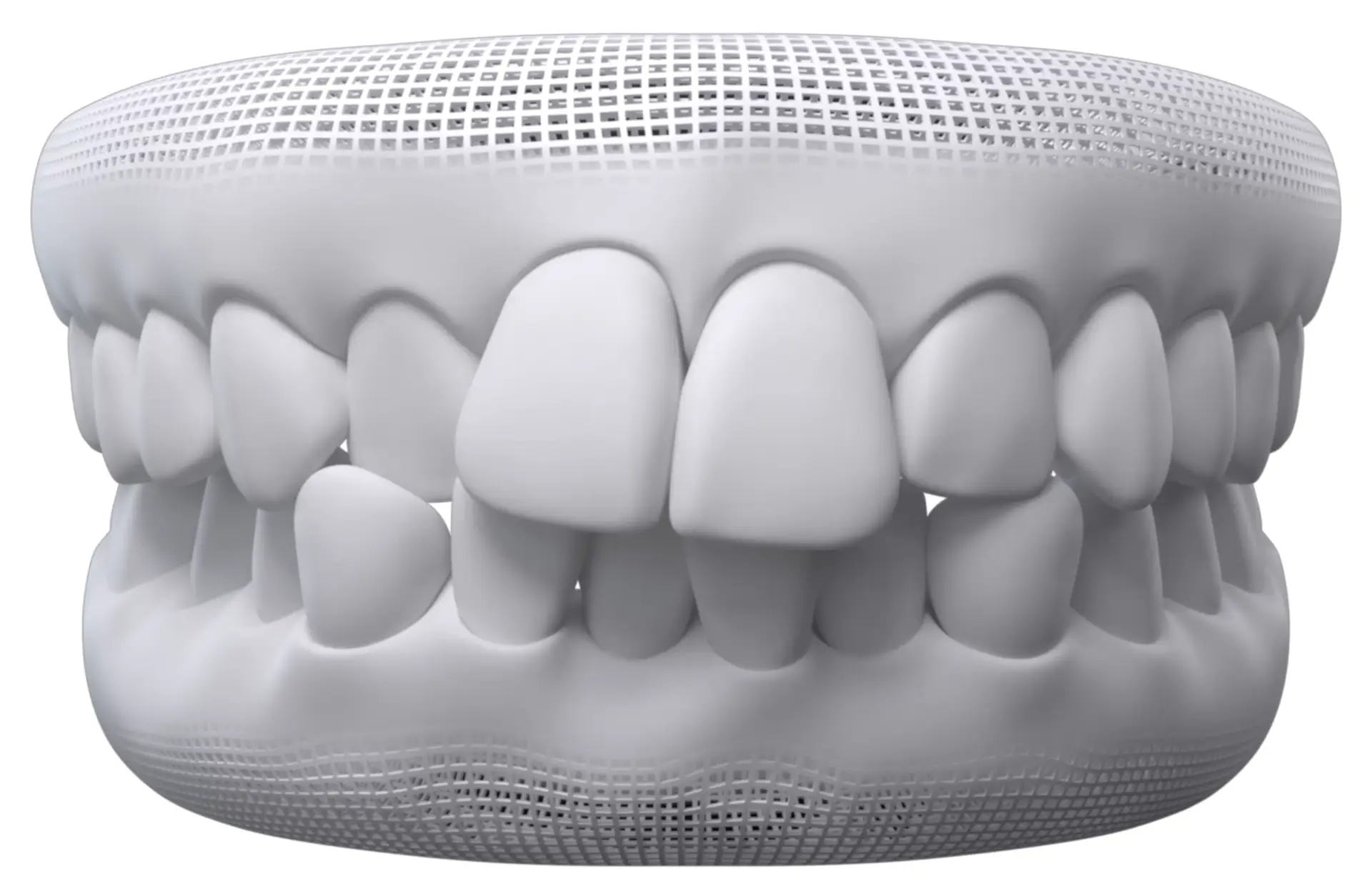 Dentes Apinhados