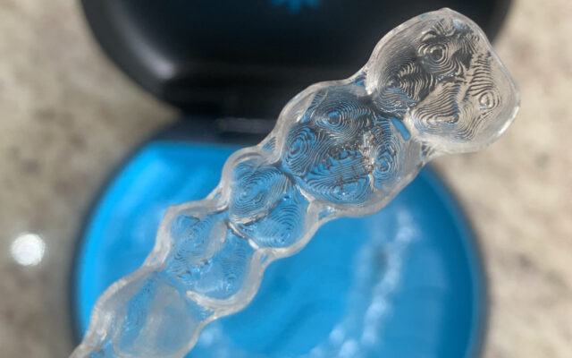 invisalign-como-funciona-de-perto