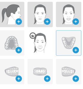 Como o Invisalign funciona?