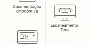 Como é feito o Invisalign