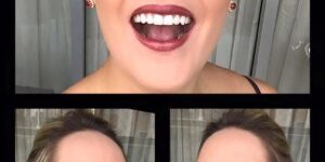 Transforme seu sorriso com Invisalign