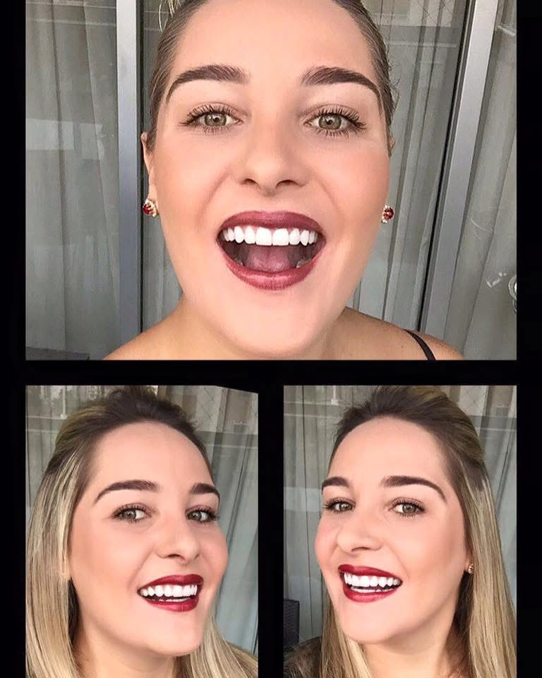 Transforme seu sorriso com Invisalign