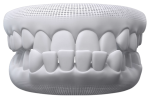 Sorriso prognata